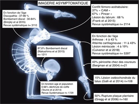 asymptomatik